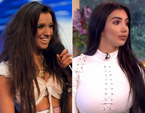 chloe khan before surgery|chloe x factor.